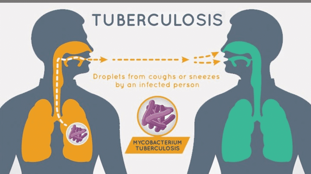 Mencegah Penularan Penyakit Tuberkulosis, Bagaimana Caranya?